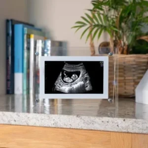 Digital Photo Frame – 7inch