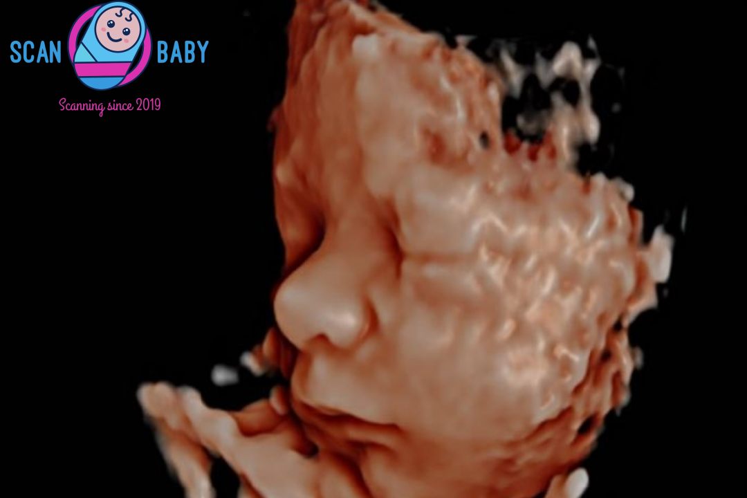 4D scan image