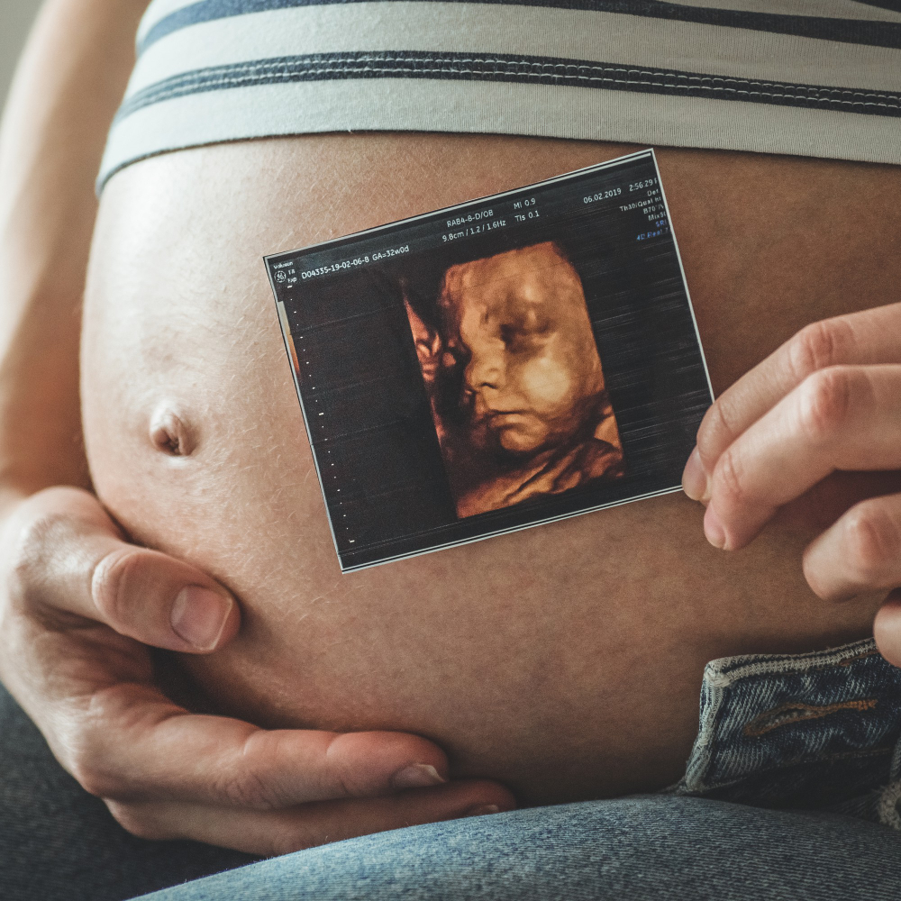 4D baby scan