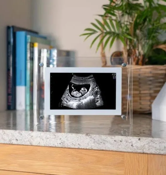 Digital Photo Frame - 7inch