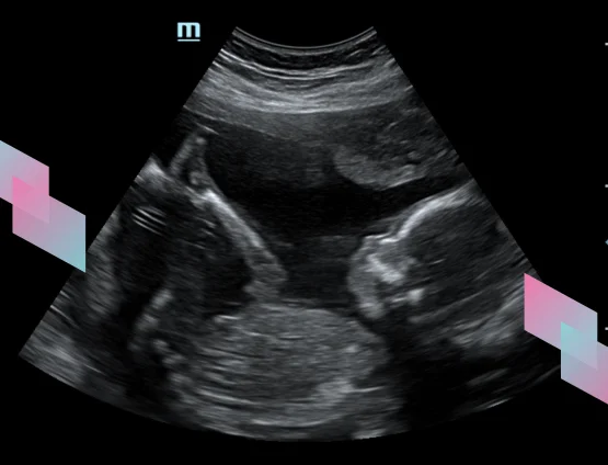 Scan Video