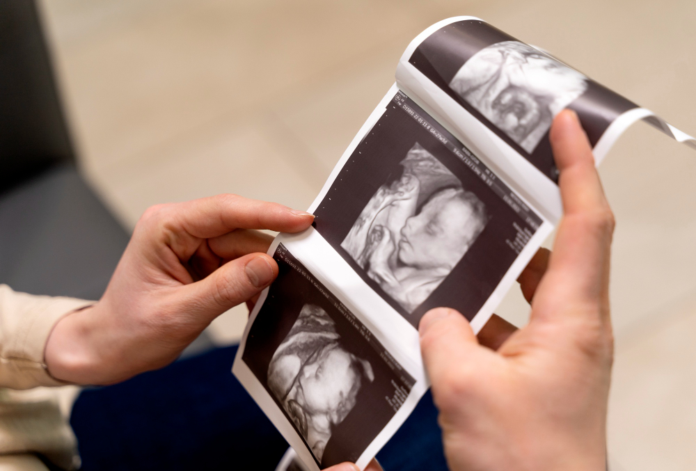 VIP 4D baby scan